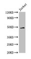 Western Blot, Positive WB detected in: Jurkat whole cell lysate, All lanes: GABPB2 antibody at 2.5ug/ml, Secondary, Goat polyclonal to rabbit IgG at 1/50000 dilution, Predicted band size: 49 kDa, Observed band size: 49 kDa Western Blot, Positive WB detected in: Jurkat whole cell lysate, All lanes: GABPB2 antibody at 2.5ug/ml, Secondary, Goat polyclonal to rabbit IgG at 1/50000 dilution, Predicted band size: 49 kDa, Observed band size: 49 kDa