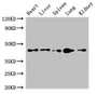 Western Blot, Positive WB detected in: Mouse heart tissue, Mouse liver tissue, Mouse spleen tissue, Mouse lung tissue, Mouse kidney tissue, All lanes: CD209 antibody at 4ug/ml, Secondary, Goat polyclonal to rabbit IgG at 1/50000 dilution, Predicted band size: 46, 36, 19, 44, 42, 31, 5, 38, 34 kDa, Observed band size: 46 kDa