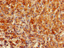 Immunohistochemistry of paraffin-embedded human adrenal gland tissue using CAC14927 at dilution of 1:100 Immunohistochemistry of paraffin-embedded human adrenal gland tissue using CAC14927 at dilution of 1:100