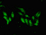 Immunofluorescent analysis of Hela cells using CAC14929 at dilution of 1:100 and Alexa Fluor 488-congugated AffiniPure Goat Anti-Rabbit IgG(H+L) Immunofluorescent analysis of Hela cells using CAC14929 at dilution of 1:100 and Alexa Fluor 488-congugated AffiniPure Goat Anti-Rabbit IgG(H+L)
