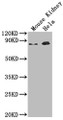 Western Blot, Positive WB detected in: Mouse Kidney tissue, Hela whole cell lysate, All lanes: Ripk1 antibody at 1:2000, Secondary, Goat polyclonal to rabbit IgG at 1/50000 dilution, Predicted band size: 75 kDa, Observed band size: 75 kDa