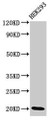 Western Blot, Positive WB detected in: HEK293 whole cell lysate, All lanes: DLX6 antibody at 3.4ug/ml, Secondary, Goat polyclonal to rabbit IgG at 1/50000 dilution, Predicted band size: 20, 30, 33 kDa, Observed band size: 20 kDa Western Blot, Positive WB detected in: HEK293 whole cell lysate, All lanes: DLX6 antibody at 3.4ug/ml, Secondary, Goat polyclonal to rabbit IgG at 1/50000 dilution, Predicted band size: 20, 30, 33 kDa, Observed band size: 20 kDa