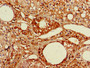 Immunohistochemistry of paraffin-embedded human adrenal gland tissue using CAC14943 at dilution of 1:100
