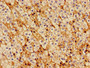 Immunohistochemistry of paraffin-embedded human adrenal gland tissue using CAC14955 at dilution of 1:100 Immunohistochemistry of paraffin-embedded human adrenal gland tissue using CAC14955 at dilution of 1:100