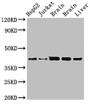 Western Blot, Positive WB detected in: HepG2 whole cell lysat, Jurkat whole cell lysate, Rat brain tissue, Mouse brain tissue, Mouse liver tissue, All lanes: IDH3A antibody at 3.4ug/ml, Secondary, Goat polyclonal to rabbit IgG at 1/50000 dilution, Predicted band size: 40, 32 kDa, Observed band size: 40 kDa