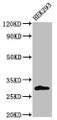 Western Blot, Positive WB detected in: HEK293 whole cell lysate, All lanes: KCNIP3 antibody at 2ug/ml, Secondary, Goat polyclonal to rabbit IgG at 1/50000 dilution, Predicted band size: 30, 27 kDa, Observed band size: 30 kDa