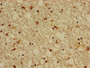 Immunohistochemistry of paraffin-embedded human brain tissue using CAC14960 at dilution of 1:100