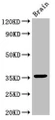 Western Blot, Positive WB detected in: Mouse brain tissue, All lanes: MNAT1 antibody at 3ug/ml, Secondary, Goat polyclonal to rabbit IgG at 1/50000 dilution, Predicted band size: 36, 32 kDa, Observed band size: 36 kDa