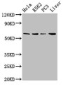 Western Blot, Positive WB detected in: Hela whole cell lysate, K562 whole cell lysate, PC-3 whole cell lysate, Mouse liver tissue, All lanes: RORA antibody at 2.7ug/ml, Secondary, Goat polyclonal to rabbit IgG at 1/50000 dilution, Predicted band size: 59, 64, 62, 54 kDa, Observed band size: 59 kDa Western Blot, Positive WB detected in: Hela whole cell lysate, K562 whole cell lysate, PC-3 whole cell lysate, Mouse liver tissue, All lanes: RORA antibody at 2.7ug/ml, Secondary, Goat polyclonal to rabbit IgG at 1/50000 dilution, Predicted band size: 59, 64, 62, 54 kDa, Observed band size: 59 kDa