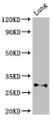 Western Blot, Positive WB detected in: Mouse lung tissue, All lanes: SPINT2 antibody at 3ug/ml, Secondary, Goat polyclonal to rabbit IgG at 1/50000 dilution, Predicted band size: 29, 22 kDa, Observed band size: 29 kDa