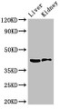 Western Blot, Positive WB detected in: Mouse liver tissue, Mouse kidney tissue, All lanes: HSD3B7 antibody at 3.5ug/ml, Secondary, Goat polyclonal to rabbit IgG at 1/50000 dilution, Predicted band size: 42, 22 kDa, Observed band size: 42 kDa