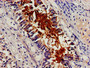 Immunohistochemistry of paraffin-embedded human lung tissue using CAC14981 at dilution of 1:100