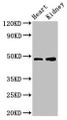 Western Blot, Positive WB detected in: Mouse heart tissue, Mouse kidney tissue, All lanes: CCNE1 antibody at 3.2ug/ml, Secondary, Goat polyclonal to rabbit IgG at 1/50000 dilution, Predicted band size: 48, 42, 46 kDa, Observed band size: 48 kDa Western Blot, Positive WB detected in: Mouse heart tissue, Mouse kidney tissue, All lanes: CCNE1 antibody at 3.2ug/ml, Secondary, Goat polyclonal to rabbit IgG at 1/50000 dilution, Predicted band size: 48, 42, 46 kDa, Observed band size: 48 kDa
