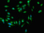 Immunofluorescent analysis of Hela cells using CAC14984 at dilution of 1:100 and Alexa Fluor 488-congugated AffiniPure Goat Anti-Rabbit IgG(H+L) Immunofluorescent analysis of Hela cells using CAC14984 at dilution of 1:100 and Alexa Fluor 488-congugated AffiniPure Goat Anti-Rabbit IgG(H+L)