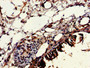 Immunohistochemistry of paraffin-embedded human lung tissue using CAC15002 at dilution of 1:100