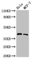 Western Blot, Positive WB detected in: Hela whole cell lysate, MCF-7 whole cell lysate, All lanes: HLA-B antibody at 3.2ug/ml, Secondary, Goat polyclonal to rabbit IgG at 1/50000 dilution, Predicted band size: 41 kDa, Observed band size: 41 kDa Western Blot, Positive WB detected in: Hela whole cell lysate, MCF-7 whole cell lysate, All lanes: HLA-B antibody at 3.2ug/ml, Secondary, Goat polyclonal to rabbit IgG at 1/50000 dilution, Predicted band size: 41 kDa, Observed band size: 41 kDa