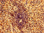Immunohistochemistry of paraffin-embedded human spleen tissue using CAC15013 at dilution of 1:100 Immunohistochemistry of paraffin-embedded human spleen tissue using CAC15013 at dilution of 1:100