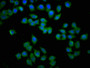 Immunofluorescence staining of Hela cells with CAC15015 at 1:133, counter-stained with DAPI. The cells were fixed in 4% formaldehyde, permeabilized using 0.2% Triton X-100 and blocked in 10% normal Goat Serum. The cells were then incubated with the antibody overnight at 4°C. The secondary antibody was Alexa Fluor 488-congugated AffiniPure Goat Anti-Rabbit IgG(H+L). Immunofluorescence staining of Hela cells with CAC15015 at 1:133, counter-stained with DAPI. The cells were fixed in 4% formaldehyde, permeabilized using 0.2% Triton X-100 and blocked in 10% normal Goat Serum. The cells were then incubated with the antibody overnight at 4°C. The secondary antibody was Alexa Fluor 488-congugated AffiniPure Goat Anti-Rabbit IgG(H+L).