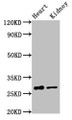 Western Blot, Positive WB detected in: Rat heart tissue, Rat kidney tissue, All lanes: OLIG1 antibody at 3.2ug/ml, Secondary, Goat polyclonal to rabbit IgG at 1/50000 dilution, Predicted band size: 28 kDa, Observed band size: 28 kDa Western Blot, Positive WB detected in: Rat heart tissue, Rat kidney tissue, All lanes: OLIG1 antibody at 3.2ug/ml, Secondary, Goat polyclonal to rabbit IgG at 1/50000 dilution, Predicted band size: 28 kDa, Observed band size: 28 kDa