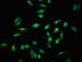 Immunofluorescent analysis of Hela cells using CAC15022 at dilution of 1:100 and Alexa Fluor 488-congugated AffiniPure Goat Anti-Rabbit IgG(H+L) Immunofluorescent analysis of Hela cells using CAC15022 at dilution of 1:100 and Alexa Fluor 488-congugated AffiniPure Goat Anti-Rabbit IgG(H+L)