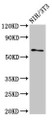 Western Blot, Positive WB detected in: NIH/3T3 whole cell lysate, All lanes: RELB antibody at 3ug/ml, Secondary, Goat polyclonal to rabbit IgG at 1/50000 dilution, Predicted band size: 63 kDa, Observed band size: 63 kDa Western Blot, Positive WB detected in: NIH/3T3 whole cell lysate, All lanes: RELB antibody at 3ug/ml, Secondary, Goat polyclonal to rabbit IgG at 1/50000 dilution, Predicted band size: 63 kDa, Observed band size: 63 kDa