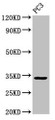 Western Blot, Positive WB detected in: PC-3 whole cell lysate, All lanes: STX1A antibody at 3ug/ml, Secondary, Goat polyclonal to rabbit IgG at 1/50000 dilution, Predicted band size: 34, 30, 29 kDa, Observed band size: 34 kDa