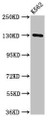 Western Blot, Positive WB detected in: K562 whole cell lysate, All lanes: SORCS1 antibody at 3ug/ml, Secondary, Goat polyclonal to rabbit IgG at 1/50000 dilution, Predicted band size: 130, 134, 132 kDa, Observed band size: 130 kDa Western Blot, Positive WB detected in: K562 whole cell lysate, All lanes: SORCS1 antibody at 3ug/ml, Secondary, Goat polyclonal to rabbit IgG at 1/50000 dilution, Predicted band size: 130, 134, 132 kDa, Observed band size: 130 kDa