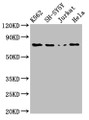 Western Blot, Positive WB detected in: K562 whole cell lysate, SH-SY5Y whole cell lysate, Jurkat whole cell lysate, Hela whole cell lysate, All lanes: PRKCB antibody at 3ug/ml, Secondary, Goat polyclonal to rabbit IgG at 1/50000 dilution, Predicted band size: 77, 78 kDa, Observed band size: 77 kDa
