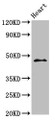 Western Blot, Positive WB detected in: Mouse heart tissue, All lanes: ING1 antibody at 3.2ug/ml, Secondary, Goat polyclonal to rabbit IgG at 1/50000 dilution, Predicted band size: 47, 32, 24, 27, 30 kDa, Observed band size: 47 kDa