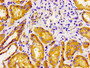 Immunohistochemistry of paraffin-embedded human kidney tissue using CAC15089 at dilution of 1:100