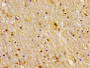 Immunohistochemistry of paraffin-embedded human brain tissue using CAC15089 at dilution of 1:100