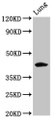 Western Blot, Positive WB detected in: Rat lung tissue, All lanes: FUT3 antibody at 5.3ug/ml, Secondary, Goat polyclonal to rabbit IgG at 1/50000 dilution, Predicted band size: 43 kDa, Observed band size: 43 kDa