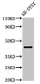 Western Blot, Positive WB detected in: SH-SY5Y whole cell lysate, All lanes: OPRM1 antibody at 2.9ug/ml, Secondary, Goat polyclonal to rabbit IgG at 1/50000 dilution, Predicted band size: 45, 44, 50, 48, 46, 56, 35, 37, 34, 14, 11, 21 kDa, Observed band size: 45 kDa