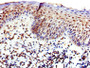 IHC image of CAC15122 diluted at 1:400 and staining in paraffin-embedded human tonsil tissue performed on a Leica BondTM system. After dewaxing and hydration, antigen retrieval was mediated by high pressure in a citrate buffer (pH 6.0). Section was blocked with 10% normal goat serum 30min at RT. Then primary antibody (1% BSA) was incubated at 4°C overnight. The primary is detected by a biotinylated secondary antibody and visualized using an HRP conjugated SP system.