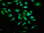 Immunofluorescence staining of Hela cells with CAC15123 at 1:100, counter-stained with DAPI. The cells were fixed in 4% formaldehyde, permeabilized using 0.2% Triton X-100 and blocked in 10% normal Goat Serum. The cells were then incubated with the antibody overnight at 4°C. The secondary antibody was Alexa Fluor 488-congugated AffiniPure Goat Anti-Rabbit IgG(H+L). Immunofluorescence staining of Hela cells with CAC15123 at 1:100, counter-stained with DAPI. The cells were fixed in 4% formaldehyde, permeabilized using 0.2% Triton X-100 and blocked in 10% normal Goat Serum. The cells were then incubated with the antibody overnight at 4°C. The secondary antibody was Alexa Fluor 488-congugated AffiniPure Goat Anti-Rabbit IgG(H+L).