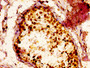 IHC image of CAC15130 diluted at 1:300 and staining in paraffin-embedded human testis tissue performed on a Leica BondTM system. After dewaxing and hydration, antigen retrieval was mediated by high pressure in a citrate buffer (pH 6.0). Section was blocked with 10% normal goat serum 30min at RT. Then primary antibody (1% BSA) was incubated at 4°C overnight. The primary is detected by a biotinylated secondary antibody and visualized using an HRP conjugated ABC system.