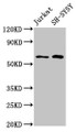 Western Blot, Positive WB detected in: Jurkat whole cell lysate, SH-SY5Y whole cell lysate, All lanes: BORA antibody at 4.8ug/ml, Secondary, Goat polyclonal to rabbit IgG at 1/50000 dilution, Predicted band size: 62, 54 kDa, Observed band size: 62 kDa