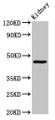 Western Blot, Positive WB detected in: Rat kidney tissue, All lanes: COX15 antibody at 3.4ug/ml, Secondary, Goat polyclonal to rabbit IgG at 1/50000 dilution, Predicted band size: 47, 44 kDa, Observed band size: 47 kDa Western Blot, Positive WB detected in: Rat kidney tissue, All lanes: COX15 antibody at 3.4ug/ml, Secondary, Goat polyclonal to rabbit IgG at 1/50000 dilution, Predicted band size: 47, 44 kDa, Observed band size: 47 kDa