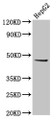 Western Blot, Positive WB detected in: HepG2 whole cell lysate, All lanes: EPSTI1 antibody at 5ug/ml, Secondary, Goat polyclonal to rabbit IgG at 1/50000 dilution, Predicted band size: 37, 36, 48 kDa, Observed band size: 48 kDa Western Blot, Positive WB detected in: HepG2 whole cell lysate, All lanes: EPSTI1 antibody at 5ug/ml, Secondary, Goat polyclonal to rabbit IgG at 1/50000 dilution, Predicted band size: 37, 36, 48 kDa, Observed band size: 48 kDa