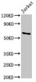 Western Blot, Positive WB detected in: Jurkat whole cell lysate, All lanes: IGF2BP1 antibody at 5.5ug/ml, Secondary, Goat polyclonal to rabbit IgG at 1/50000 dilution, Predicted band size: 64, 49 kDa, Observed band size: 64 kDa