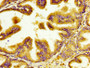 IHC image of CAC15149 diluted at 1:400 and staining in paraffin-embedded human prostate tissue performed on a Leica BondTM system. After dewaxing and hydration, antigen retrieval was mediated by high pressure in a citrate buffer (pH 6.0). Section was blocked with 10% normal goat serum 30min at RT. Then primary antibody (1% BSA) was incubated at 4°C overnight. The primary is detected by a biotinylated secondary antibody and visualized using an HRP conjugated SP system.