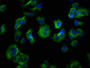 Immunofluorescence staining of MCF-7 cells with CAC15151 at 1:133, counter-stained with DAPI. The cells were fixed in 4% formaldehyde, permeabilized using 0.2% Triton X-100 and blocked in 10% normal Goat Serum. The cells were then incubated with the antibody overnight at 4°C. The secondary antibody was Alexa Fluor 488-congugated AffiniPure Goat Anti-Rabbit IgG(H+L).