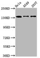 Western Blot, Positive WB detected in: Hela whole cell lysate, A549 whole cell lysate, 293T whole cell lysate, All lanes: MAN2B2 antibody at 1.4ug/ml, Secondary, Goat polyclonal to rabbit IgG at 1/50000 dilution, Predicted band size: 114, 108 kDa, Observed band size: 135 kDa