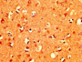 IHC image of CAC15159 diluted at 1:400 and staining in paraffin-embedded human brain tissue performed on a Leica BondTM system. After dewaxing and hydration, antigen retrieval was mediated by high pressure in a citrate buffer (pH 6.0). Section was blocked with 10% normal goat serum 30min at RT. Then primary antibody (1% BSA) was incubated at 4°C overnight. The primary is detected by a biotinylated secondary antibody and visualized using an HRP conjugated SP system.