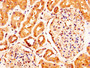 IHC image of CAC15162 diluted at 1:290 and staining in paraffin-embedded human kidney tissue performed on a Leica BondTM system. After dewaxing and hydration, antigen retrieval was mediated by high pressure in a citrate buffer (pH 6.0). Section was blocked with 10% normal goat serum 30min at RT. Then primary antibody (1% BSA) was incubated at 4°C overnight. The primary is detected by a biotinylated secondary antibody and visualized using an HRP conjugated SP system.