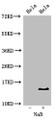 Western Blot, Positive WB detected in: Hela cell acid extracts treated by NaB, All lanes: HIST1H2BB antibody at 2ug/ml, Secondary, Goat polyclonal to rabbit IgG at 1/50000 dilution, Predicted band size: 14 kDa, Observed band size: 14 kDa