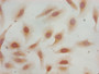 Immunocytochemistry analysis of Hela cells using CAC15173 at dilution of 1:100