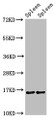Western Blot, Positive WB detected in: Mouse spleen tissue, Rat spleen tissue, All lanes: HIST1H3A antibody at 1.4ug/ml, Secondary, Goat polyclonal to rabbit IgG at 1/50000 dilution, Predicted band size: 16 kDa, Observed band size: 16 kDa Western Blot, Positive WB detected in: Mouse spleen tissue, Rat spleen tissue, All lanes: HIST1H3A antibody at 1.4ug/ml, Secondary, Goat polyclonal to rabbit IgG at 1/50000 dilution, Predicted band size: 16 kDa, Observed band size: 16 kDa