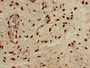 Immunohistochemistry of paraffin-embedded human lung cancer using CAC15178 at dilution of 1:100