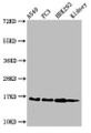 Western Blot, Positive WB detected in: A549 cell acid extracts, PC-3 cell acid extracts, HEK293 cell acid extracts, Mouse kidney tissue, All lanes: HIST1H3A antibody at 2ug/ml, Secondary, Goat polyclonal to rabbit IgG at 1/50000 dilution, Predicted band size: 16 kDa, Observed band size: 16 kDa